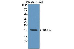 Western blot analysis of the recombinant protein. (FLRT3 anticorps  (AA 29-152))