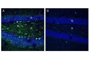 Expression of Netrin-1 in mouse hippocampus. (Netrin 1 anticorps  (Secreted))