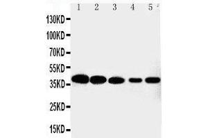 Anti-Cdk7 antibody,  Western blotting Lane 1: HELA Cell Lysate Lane 2: MCF-7 Cell Lysate Lane 3: A549 Cell Lysate Lane 4: COLO320 Cell Lysate Lane 5: JURKAT Cell Lysate (CDK7 anticorps  (C-Term))