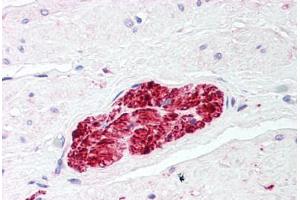 Human Prostate, Nerve (formalin-fixed, paraffin-embedded) stained with S100 Protein antibody ABIN214427 at 2. (S100 Protein (S100) anticorps)