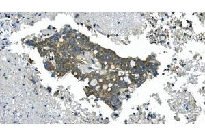 IHC analysis of CDC123 using anti-CDC123 antibody (ABIN7599284). (CDC123 anticorps  (AA 1-336))