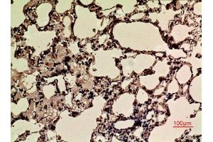 Immunohistochemistry (IHC) analysis of paraffin-embedded Rat Lung, antibody was diluted at 1:100.