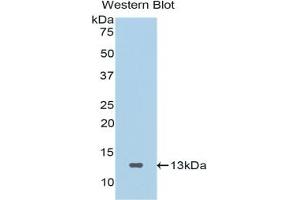 Detection of Recombinant SFRP4, Human using Polyclonal Antibody to Secreted Frizzled Related Protein 4 (SFRP4)