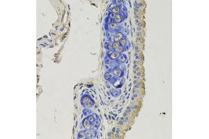 Immunohistochemistry of paraffin-embedded mouse lung using GPHN antibody (ABIN5996450) at dilution of 1/100 (40x lens). (Gephyrin anticorps)