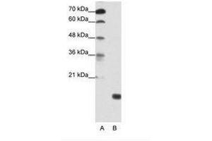 Image no. 1 for anti-TGFB-Induced Factor Homeobox 2-Like, Y-Linked (TGIF2LY) (AA 99-148) antibody (ABIN203023) (TGIF2LY anticorps  (AA 99-148))