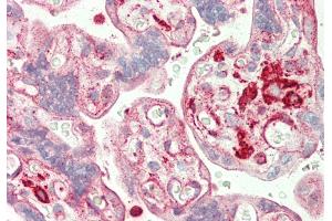 Rabbit Anti-ST3GAL4 antibody  Formalin Fixed Paraffin Embedded Tissue: Human Placenta Primary antibody Concentration: 1:200 Secondary Antibody: Donkey anti-Rabbit-Cy3 Secondary Antibody Concentration: 1:200 Magnification: 20x Exposure Time: 0.