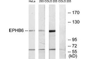 Western blot analysis of extracts from COLO/293/HeLa cells, using EPHB6 Antibody. (EPH Receptor B6 anticorps  (AA 861-910))