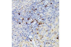 Immunohistochemistry of paraffin-embedded rat spleen using Cathepsin G Rabbit pAb (ABIN6127687, ABIN6139229, ABIN6139231 and ABIN6221273) at dilution of 1:50 (40x lens).