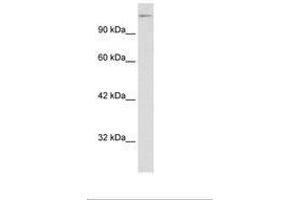 Image no. 3 for anti-Transcription Elongation Factor SPT5 (SUPT5H) (AA 892-941) antibody (ABIN6735860) (SUPT5H anticorps  (AA 892-941))