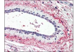 Human Breast (formalin-fixed, paraffin-embedded) stained with WNT3at 3. (WNT3 anticorps  (Internal Region))
