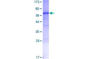 Image no. 1 for serpin Peptidase Inhibitor, Clade B (Ovalbumin), Member 3 (SERPINB3) (AA 1-390) protein (GST tag) (ABIN1319616)