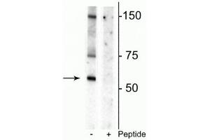 Western blot of rat striatal lysate showing specific immunolabeling of the ~55 kDa glycosylated form of the DAT protein phosphorylated at Thr53 in the first lane (-). (SLC6A3 anticorps  (pThr53))