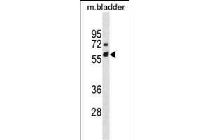 Mouse Krt6a Antibody (Center) (ABIN1881486 and ABIN2838719) western blot analysis in mouse bladder tissue lysates (35 μg/lane). (KRT6A anticorps  (AA 212-240))