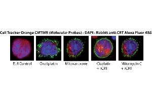 Calreticulin Protein (CALR) (His tag)
