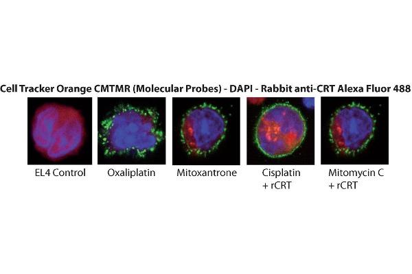 Calreticulin Protein (CALR) (His tag)