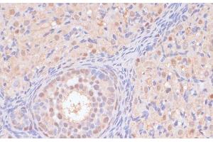 Immunohistochemistry of paraffin-embedded Rat ovary using BYSL Polyclonal Antibody at dilution of 1:100 (40x lens). (Bystin-Like anticorps)
