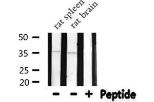 Western blot analysis of NEUROD1 expression in various lysates