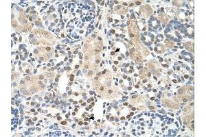 Immunohistochemistry (IHC) image for anti-phosphoserine Aminotransferase 1 (PSAT1) (N-Term) antibody (ABIN2782576)