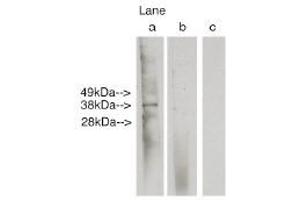 Image no. 1 for anti-Ceramide Synthase 6 (CERS6) antibody (ABIN4620354) (CERS6 anticorps)