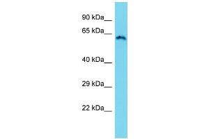 Western Blotting (WB) image for anti-Zinc Finger, CW Type with PWWP Domain 1 (ZCWPW1) (N-Term) antibody (ABIN2791107) (ZCWPW1 anticorps  (N-Term))