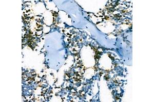 Immunohistochemistry of paraffin embedded mouse bone using AHSP (ABIN7073016) at dilution of 1:300 (400x lens) (aHSP anticorps)