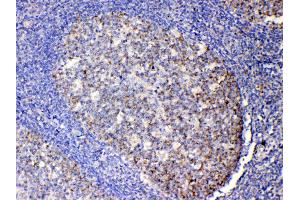 IHC analysis of IL13 using anti-IL13 antibody . (IL-13 anticorps  (AA 36-146))