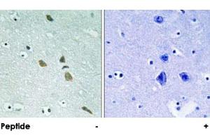 Immunohistochemical analysis of paraffin-embedded human brain tissue using ILK polyclonal antibody . (ILK anticorps)