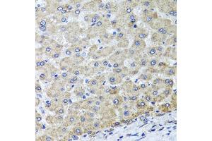 Immunohistochemistry of paraffin-embedded human liver injury using OSGEPL1 antibody (ABIN5974954) at dilution of 1/100 (40x lens). (OSGEPL1 anticorps)