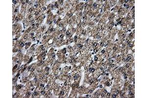 Immunohistochemical staining of paraffin-embedded liver tissue using anti-BRAFmouse monoclonal antibody. (BRAF anticorps)