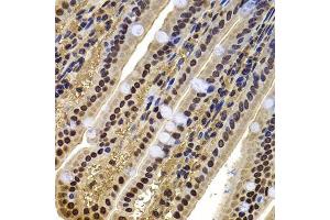 Immunohistochemistry of paraffin-embedded mouse jejunum using ACTL6B antibody.