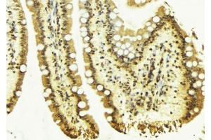 ABIN6276686 at 1/100 staining Mouse colon tissue by IHC-P.