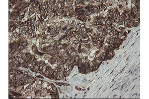 Image no. 7 for anti-Family with Sequence Similarity 164, Member A (FAM164A) antibody (ABIN1498198) (FAM164A anticorps)