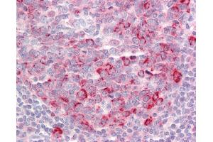 Anti-TSHZ1 antibody IHC staining of human tonsil.