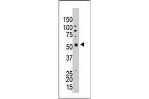 The PPP5C polyclonal antibody  is used in Western blot to detect PPP5C in HL-60 cell lysate. (PP5 anticorps  (C-Term))