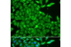 Immunofluorescence analysis of A549 cells using CSNK1G2 Polyclonal Antibody (Casein Kinase 1 gamma 2 anticorps)