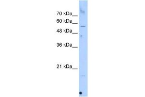 WB Suggested Anti-SEPN1 Antibody Titration:  0. (SEPN1 anticorps  (C-Term))