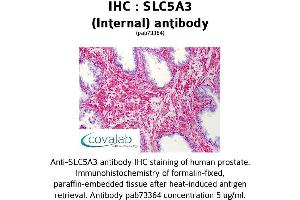 Image no. 1 for anti-Solute Carrier Family 5 Member 3 (SLC5A3) (Internal Region) antibody (ABIN1739401) (SLC5A3 anticorps  (Internal Region))