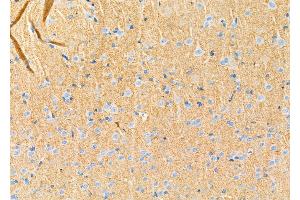 ABIN6264742 and ABIN6272414 at 1/100 staining Rat brain tissue by IHC-P. (RHOG anticorps  (Internal Region))