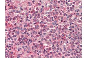 Image no. 1 for anti-Chemokine (C-X-C Motif) Receptor 4 (CXCR4) (AA 14-40), (Extracellular Domain), (N-Term) antibody (ABIN372808)