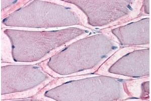 Human Skeletal Muscle: Formalin-Fixed, Paraffin-Embedded (FFPE)