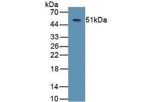 Detection of Recombinant ASPH, Human using Monoclonal Antibody to Aspartate Beta Hydroxylase (ASPH) (Aspartate beta Hydroxylase anticorps  (AA 345-758))