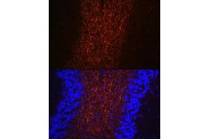Immunofluorescence analysis of mouse brain using Neurofilament H Rabbit pAb (ABIN6129638, ABIN6144512, ABIN6144513 and ABIN6224502) at dilution of 1:100 (40x lens). (NEFH anticorps  (AA 821-1020))