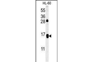 Western blot analysis in HL-60 cell line lysates (35ug/lane). (CD69 anticorps  (AA 119-148))
