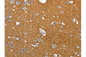 The image on the left is immunohistochemistry of paraffin-embedded Human brain tissue using ABIN7192659(SSTR4 Antibody) at dilution 1/25, on the right is treated with synthetic peptide. (SSTR4 anticorps)