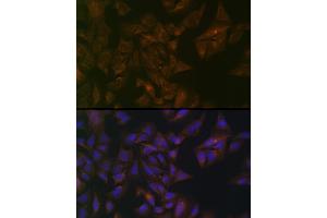 Immunofluorescence analysis of U-2 OS cells using Folate Binding Protein(FBP) / FOLR1 Rabbit pAb (ABIN7267224) at dilution of 1:100 (40x lens).
