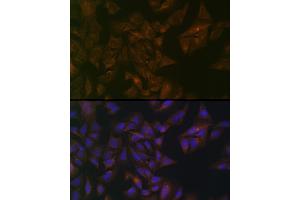 Immunofluorescence analysis of U-2 OS cells using Folate Binding Protein(FBP) / FOLR1 Rabbit pAb (ABIN7267224) at dilution of 1:100 (40x lens). (FOLR1 anticorps  (AA 25-93))