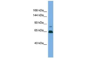 Western Blotting (WB) image for anti-Zinc Finger Protein 676 (ZNF676) (Middle Region) antibody (ABIN2787553) (ZNF676 anticorps  (Middle Region))