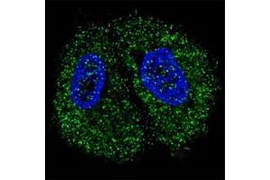 Fluorescent confocal image of MCF7 cells stained with PKM2 antibody.