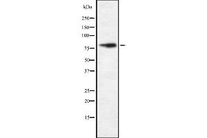 Western blot analysis FAKD2 using HeLa whole cell lysates (FASTKD2 anticorps  (Internal Region))