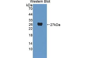 Western blot analysis of the recombinant protein. (PAG1 anticorps  (AA 138-357))